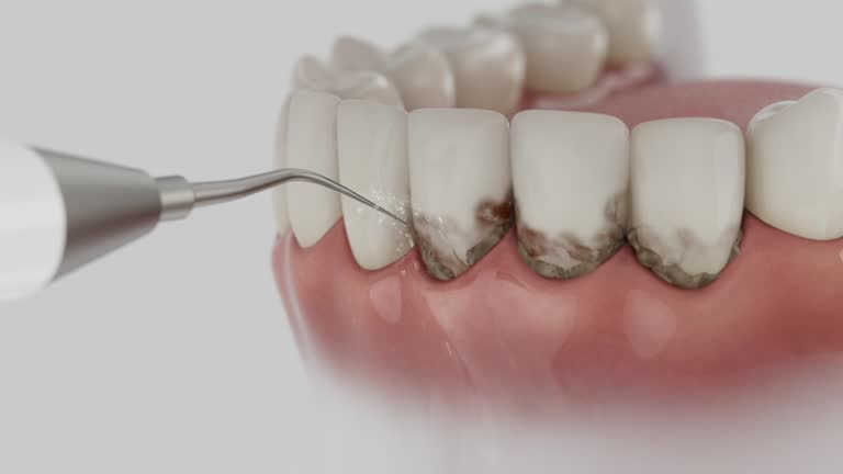 Reliable Dental Implants contractor in Cedar Creek, TX by Smile Center Dentistry